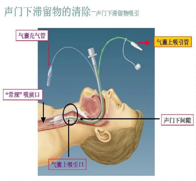 气囊压力监控仪1